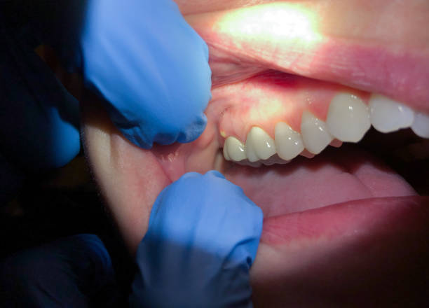 Best Emergency Orthodontic Repairs in Mount Union, PA