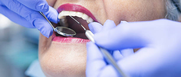 Best Emergency Broken Tooth Repair in Mount Union, PA